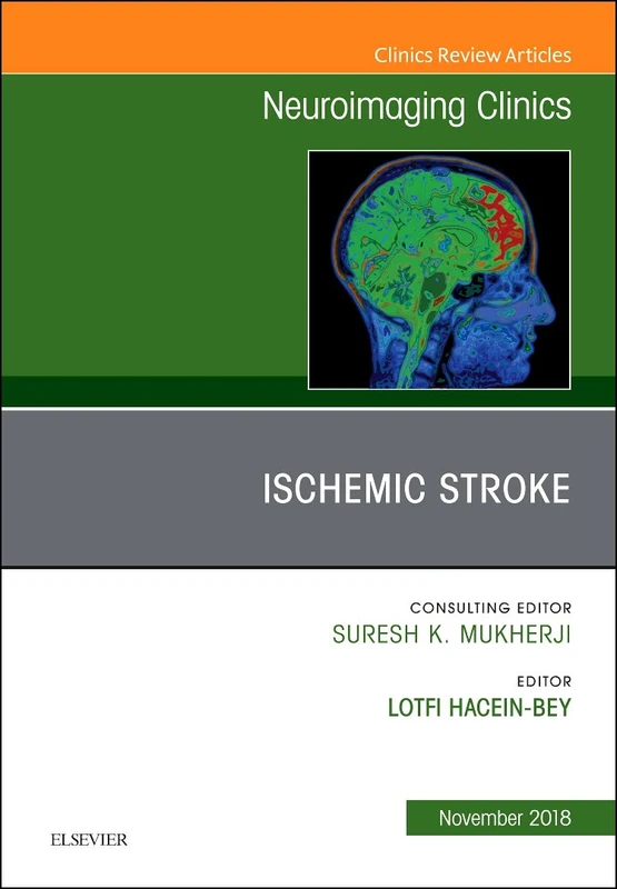Ischemic Stroke, An Issue of Neuroimaging Clinics of North America (Volume 28-4) (The Clinics: Radiology, Volume 28-4)