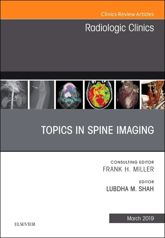Topics in Spine Imaging, An Issue of Radiologic Clinics of North America (Volume 57-2) (The Clinics: Radiology, Volume 57-2)
