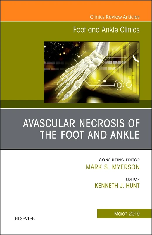 Avascular necrosis of the foot and ankle, An issue of Foot and Ankle Clinics of North America (Volume 24-1) (The Clinics: Orthopedics, Volume 24-1)