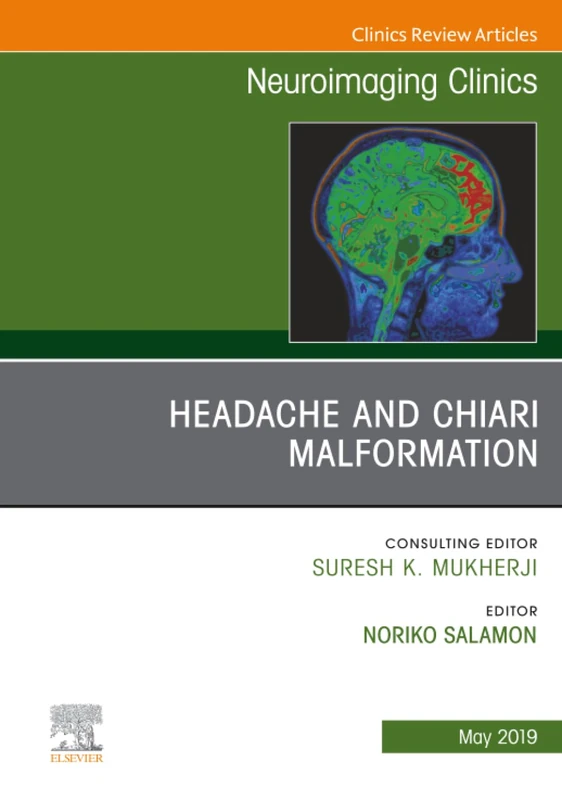 Headache and Chiari Malformation, An Issue of Neuroimaging Clinics of North America: Volume 29-2 (The Clinics: Radiology, Volume 29-2)
