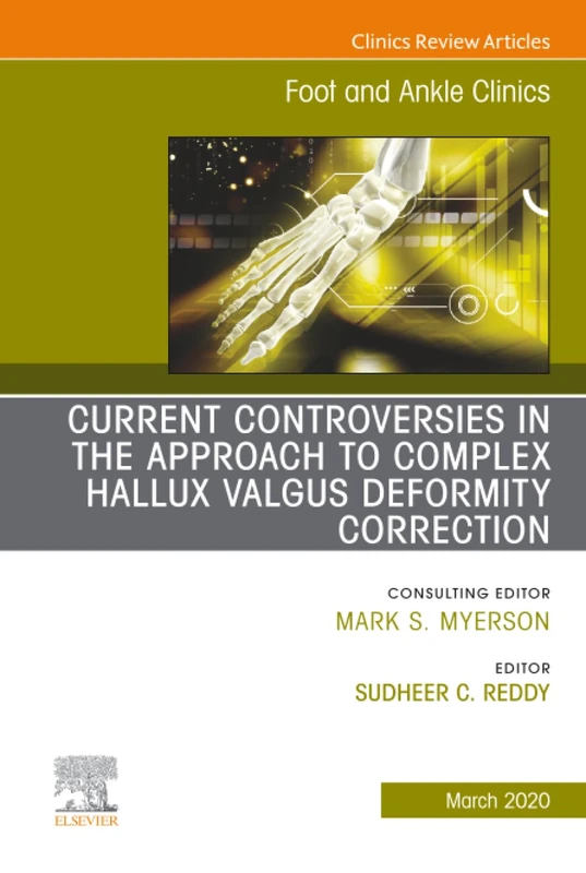 Controversies in the Approach to Complex Hallux Valgus Deformity Correction, An issue of Foot and Ankle Clinics of North America: Volume 25-1 (The Clinics: Orthopedics, Volume 25-1)