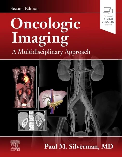 Oncologic Imaging: A Multidisciplinary Approach: Expert Consult - Online and Print