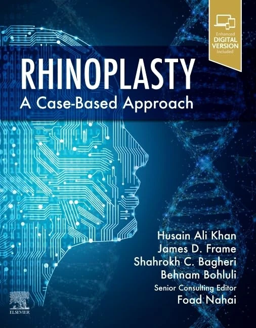 Rhinoplasty: a Case-based approach
