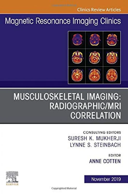 Musculoskeletal Imaging: Radiographic/MRI Correlation, An Issue of Magnetic Resonance Imaging Clinics of North America (Volume 27-4) (The Clinics: Radiology, Volume 27-4)