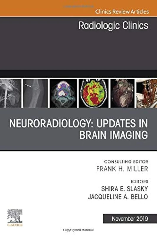 Neuroradiology, An Issue of Radiologic Clinics of North America (Volume 57-6) (The Clinics: Radiology, Volume 57-6)