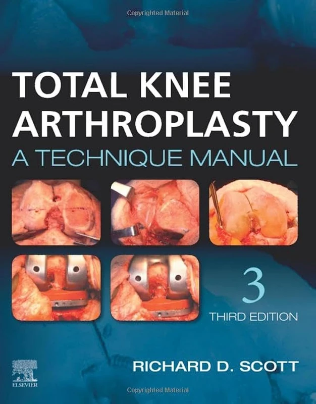 Total Knee Arthroplasty: A Technique Manual