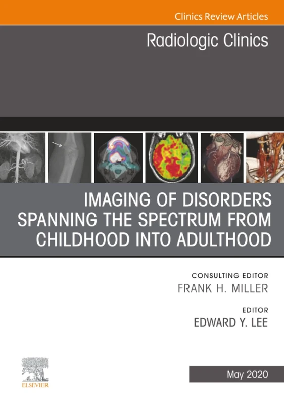 Imaging of Disorders Spanning the Spectrum from Childhood, An Issue of Radiologic Clinics of North America: Volume 58-3 (The Clinics: Radiology, Volume 58-3)