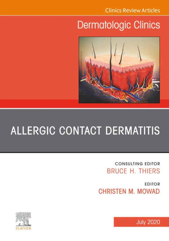 Allergic Contact Dermatitis, An Issue of Dermatologic Clinics: Volume 38-3 (The Clinics: Dermatology, Volume 38-3)