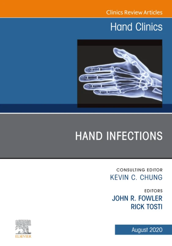 Hand Infections, An Issue of Hand Clinics: Volume 36-3 (The Clinics: Orthopedics, Volume 36-3)