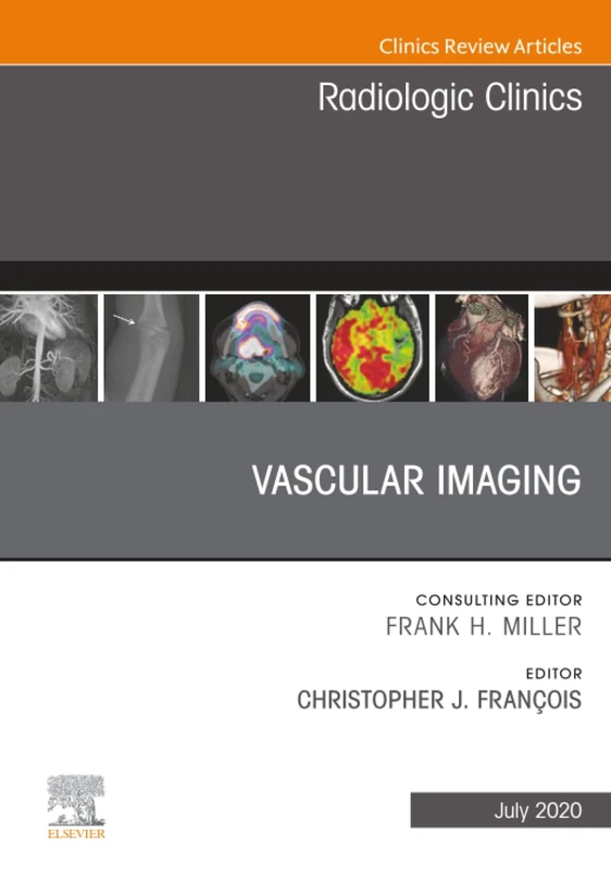 Vascular Imaging, An Issue of Radiologic Clinics of North America: Volume 58-4 (The Clinics: Radiology, Volume 58-4) - Image 1
