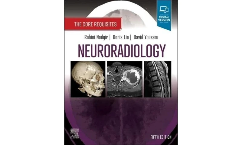 Neuroradiology: The Core Requisites
