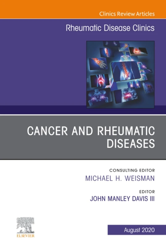 Cancer and Rheumatic Diseases, An Issue of Rheumatic Disease Clinics of North America: Volume 46-3 (The Clinics: Internal Medicine, Volume 46-3)