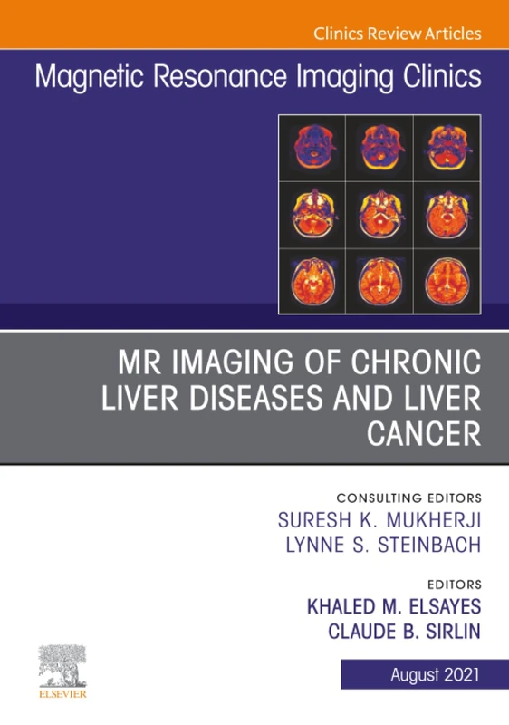 MR Imaging of Chronic Liver Diseases and Liver Cancer, An Issue of Magnetic Resonance Imaging Clinics of North America: Volume 29-3 (The Clinics: Radiology, Volume 29-3)