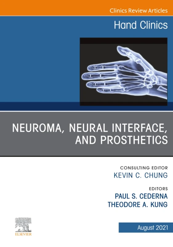 Neuroma, Neural Interface, and Prosthetics, An Issue of Hand Clinics: Volume 37-3 (The Clinics: Orthopedics, Volume 37-3)