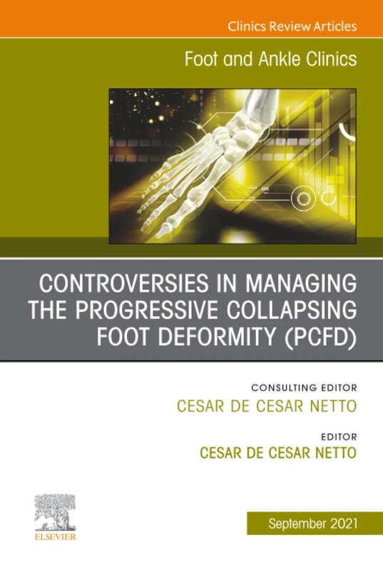 Controversies in Managing the Progressive Collapsing Foot Deformity (PCFD), An issue of Foot and Ankle Clinics of North America: Volume 26-3 (The Clinics: Orthopedics, Volume 26-3)