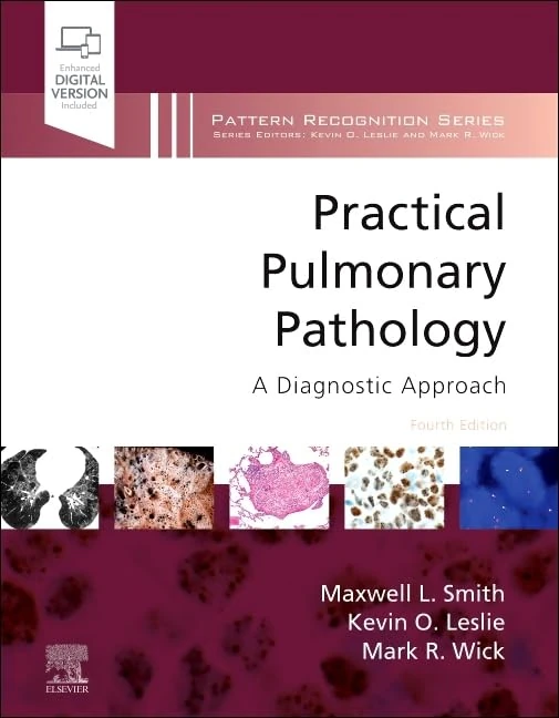 Practical Pulmonary Pathology: A Diagnostic Approach (Pattern Recognition)