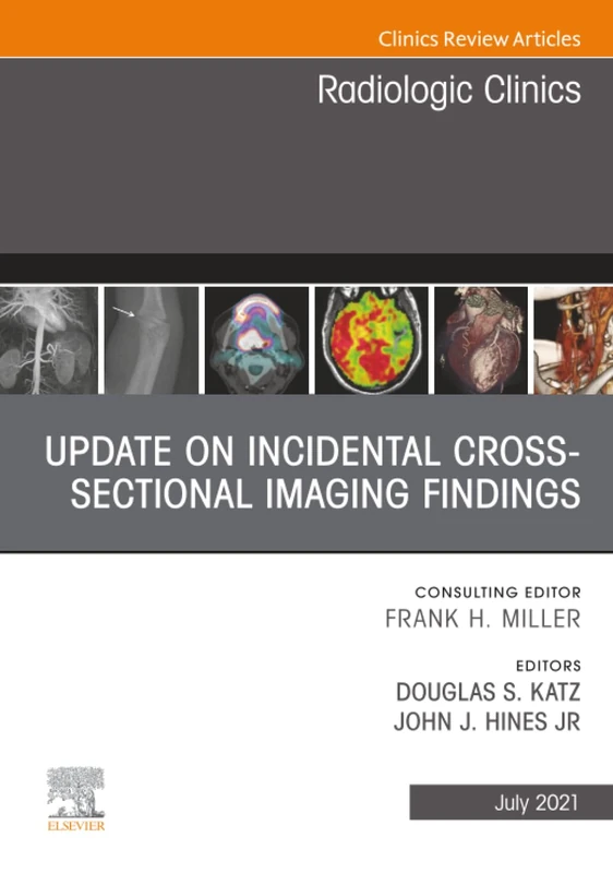 Update on Incidental Cross-sectional Imaging Findings, An Issue of Radiologic Clinics of North America: Volume 59-4 (The Clinics: Radiology, Volume 59-4)