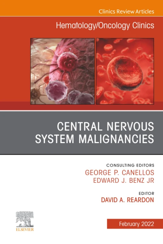 Central Nervous System Malignancies, An Issue of Hematology/Oncology Clinics of North America: Volume 36-1 (The Clinics: Internal Medicine, Volume 36-1)