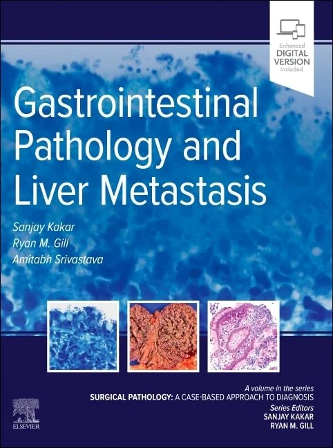 Gastrointestinal Pathology and Liver Metastasis: A Case-Based Approach to Diagnosis (Surgical Pathology: A Case Based Approach to Diagnosis)