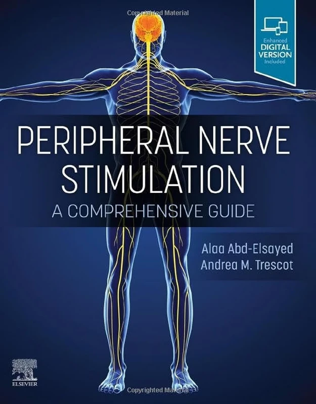 Peripheral Nerve Stimulation: A Comprehensive Guide