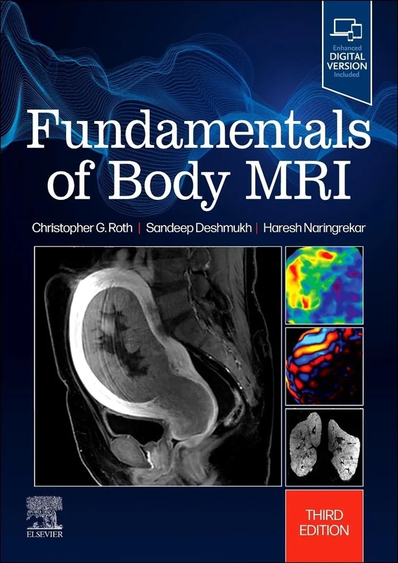 Fundamentals of Body MRI (Fundamentals of Radiology)