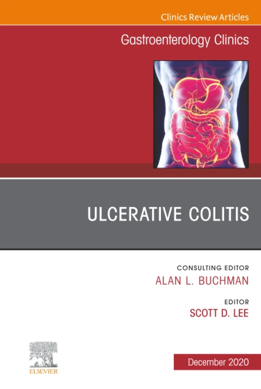 Ulcerative Colitis, An Issue of Gastroenterology Clinics of North America: Volume 49-4 (The Clinics: Internal Medicine, Volume 49-4)