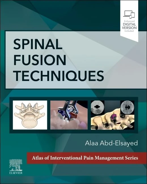 Spinal Fusion Techniques (The Atlas of Interventional Pain Management)