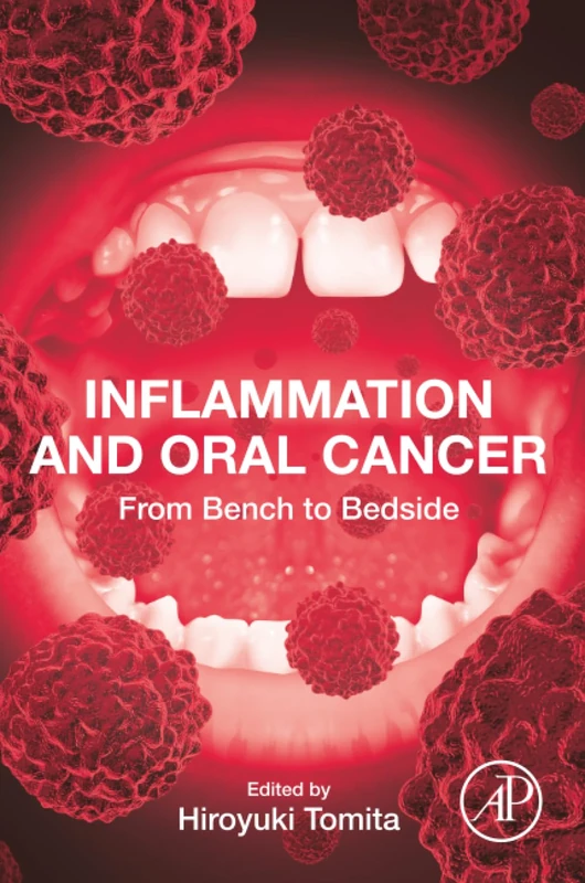 Inflammation and Oral Cancer: From Bench to Bedside
