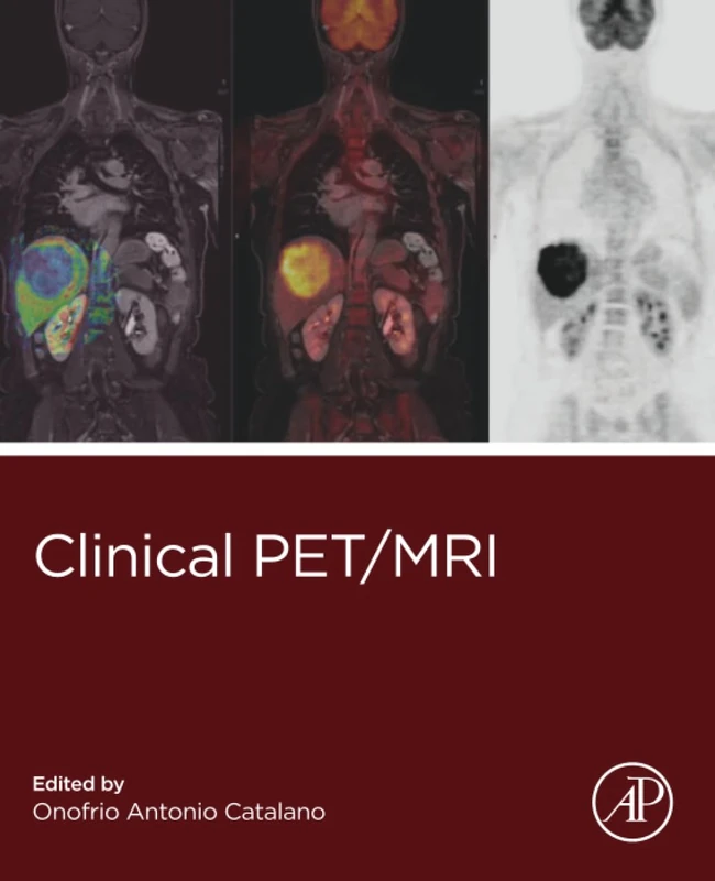 Academic Press Clinical PET/MRI - Medical Imaging Textbook