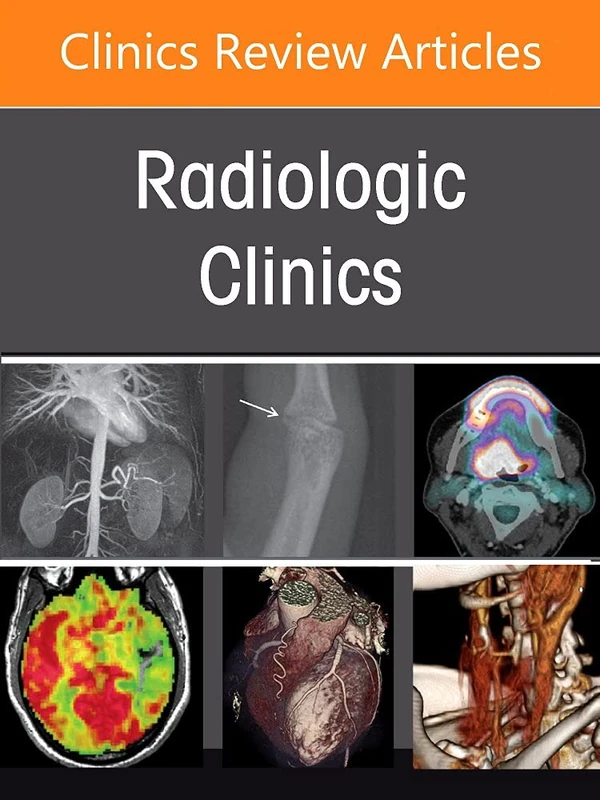 Thoracic Infections, An Issue of Radiologic Clinics of North America (Volume 60-3) (The Clinics: Internal Medicine, Volume 60-3)