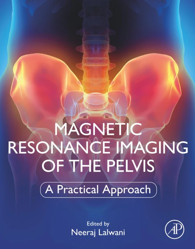 Academic Press - Magnetic Resonance Imaging of The Pelvis
