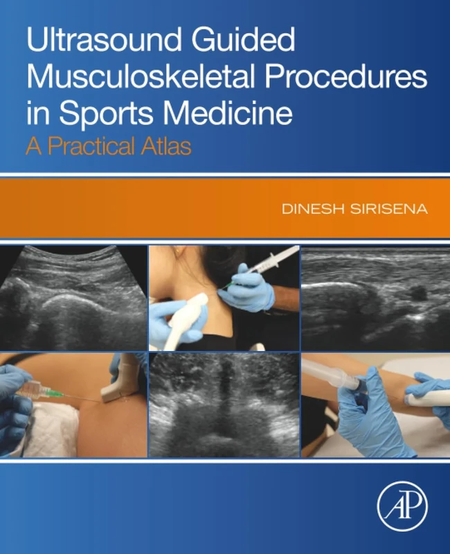 Ultrasound Guided Musculoskeletal Procedures in Sports Medicine: A Practical Atlas
