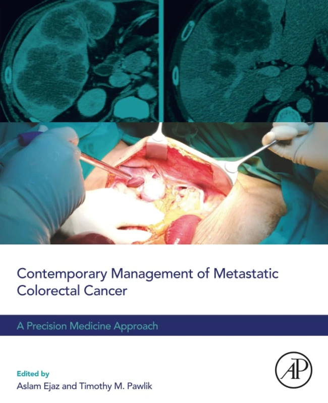 Contemporary Management of Metastatic Colorectal Cancer: A Precision Medicine Approach