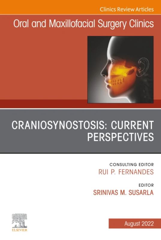 Craniosynostosis: Current Perspectives, An Issue of Oral and Maxillofacial Surgery Clinics of North America: Volume 34-3 (The Clinics: Internal Medicine, Volume 34-3)