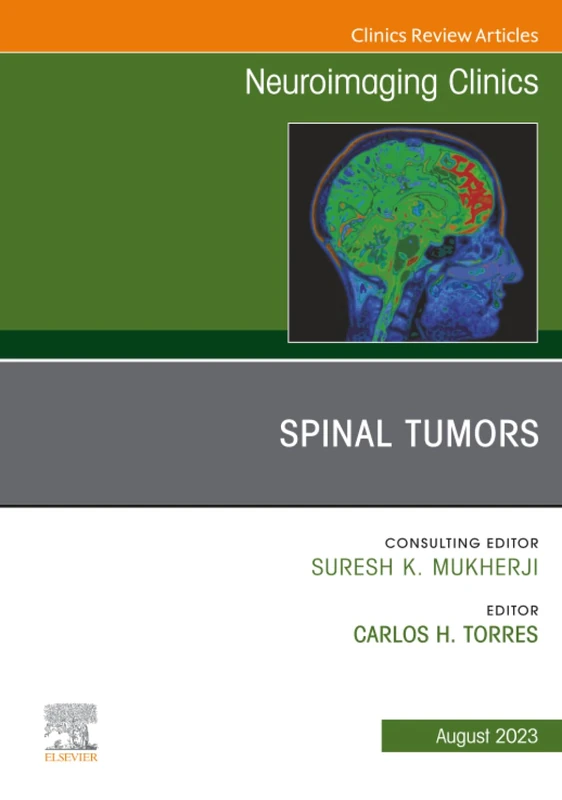 Spinal Tumors, An Issue of Neuroimaging Clinics of North America: Volume 33-3 (The Clinics: Radiology, Volume 33-3)