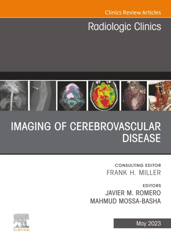Imaging of Cerebrovascular Disease, An Issue of Radiologic Clinics of North America: Volume 61-3 (The Clinics: Radiology, Volume 61-3)