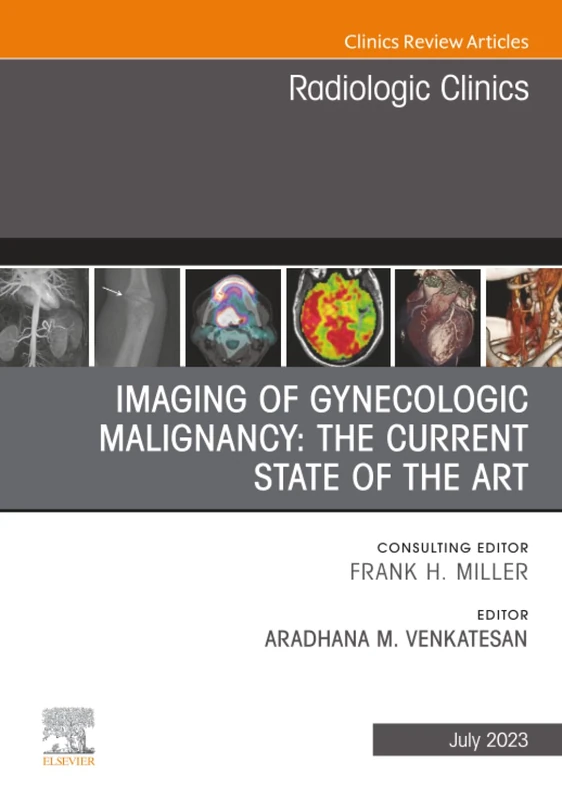 Imaging of Gynecologic Malignancy: The Current State of the Art, An Issue of Radiologic Clinics of North America: Volume 61-4 (The Clinics: Radiology, Volume 61-4)