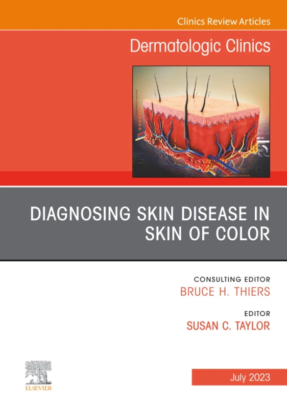 Diagnosing Skin Disease in Skin of Color, An Issue of Dermatologic Clinics: Volume 41-3 (The Clinics: Dermatology, Volume 41-3)