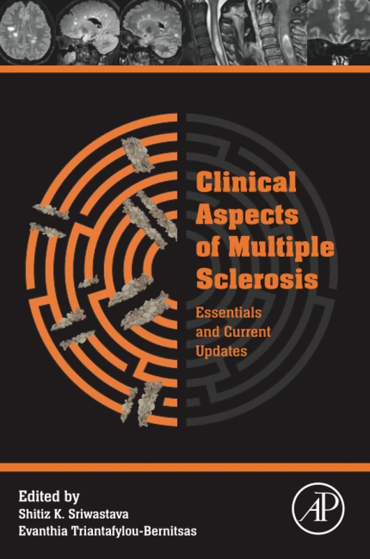 Clinical Aspects of Multiple Sclerosis Essentials and Current Updates