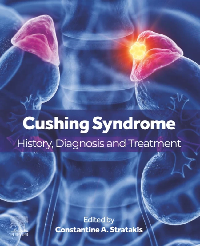 Cushing Syndrome: History, Diagnosis and Treatment