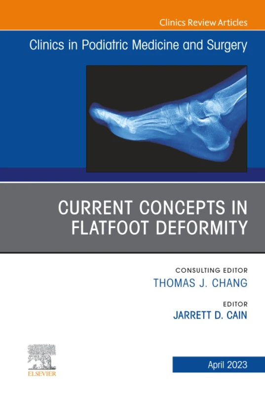 Current Concepts in Flatfoot Deformity, An Issue of Clinics in Podiatric Medicine and Surgery: Volume 40-2 (The Clinics: Orthopedics, Volume 40-2)