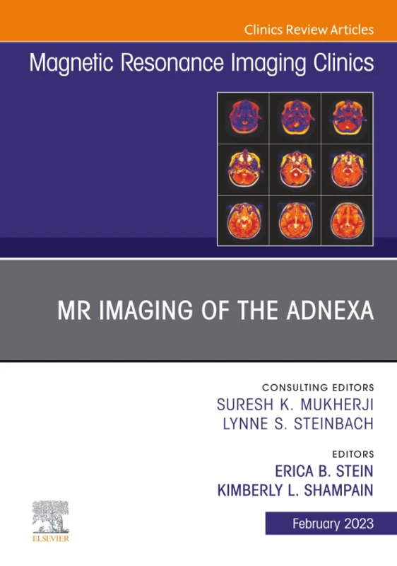 MR Imaging of the Adnexa, An Issue of Magnetic Resonance Imaging Clinics of North America: Volume 31-1 (The Clinics: Radiology, Volume 31-1)