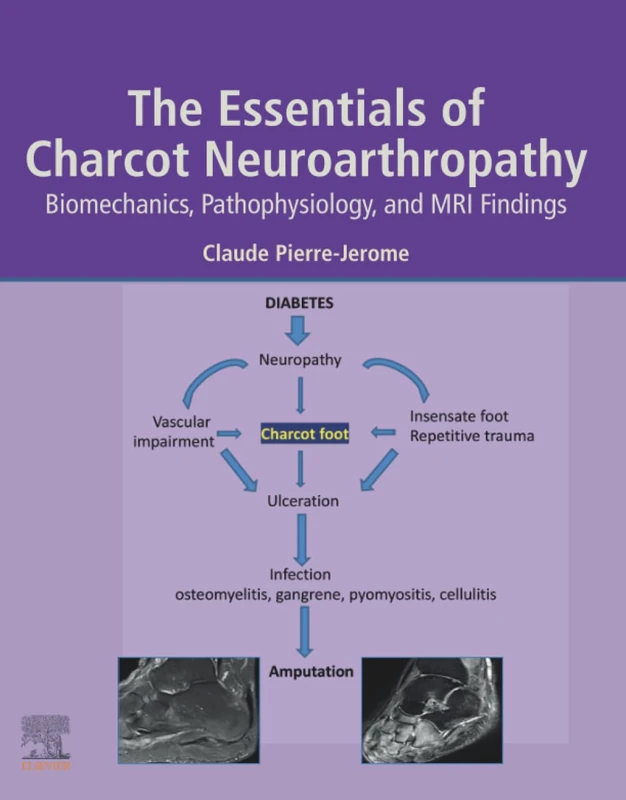 Elsevier - The Essentials of Charcot Neuroarthropathy Book