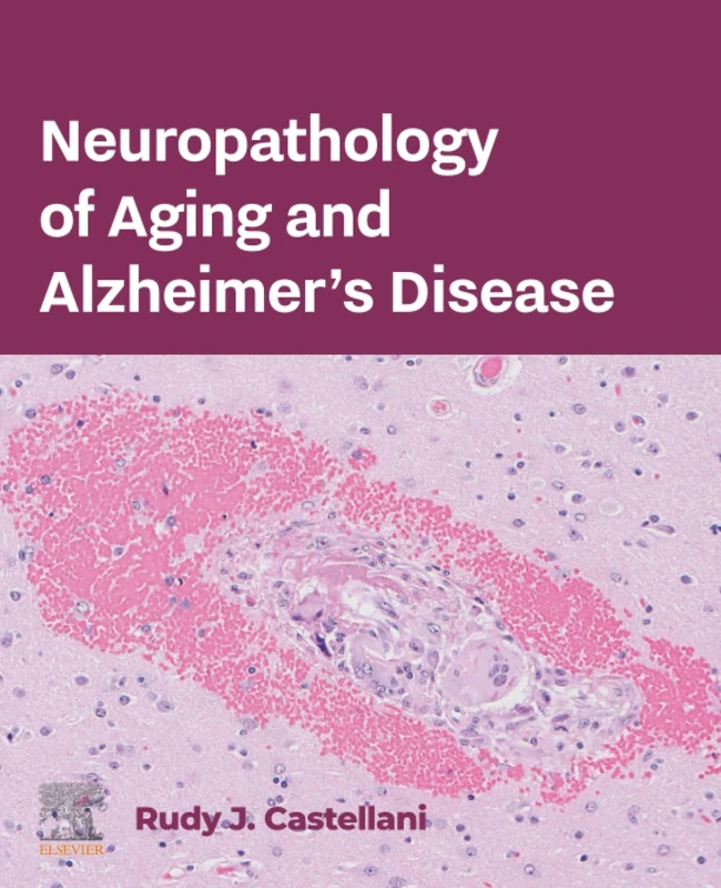 Elsevier Neuropathology of Aging and Alzheimer's Disease Book