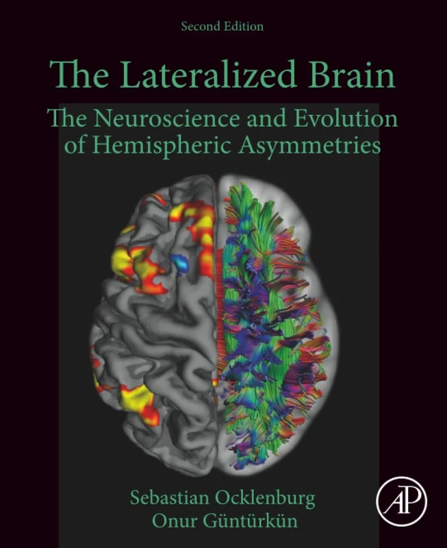 The Lateralized Brain: The Neuroscience and Evolution of Hemispheric Asymmetries