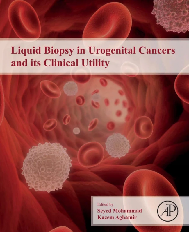Academic Press - Liquid Biopsy in Urogenital Cancers Book