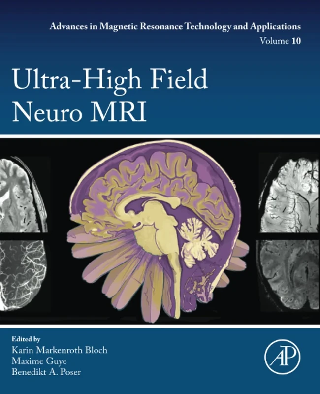 Ultra-High Field Neuro MRI: Volume 10 (Advances in Magnetic Resonance Technology and Applications, Volume 10) - Image 1