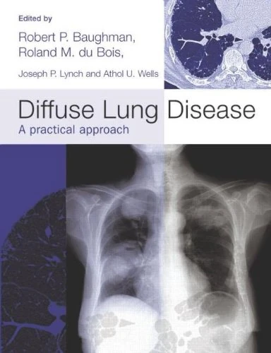 Diffuse Lung Disease: A practical approach