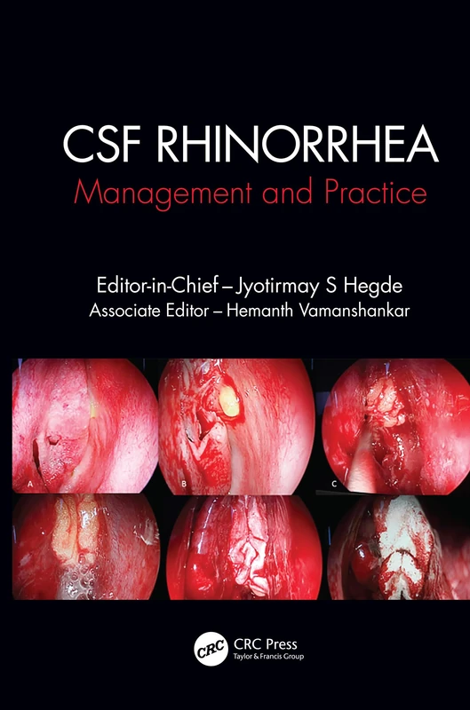 CRC Press CSF Rhinorrhoea: Management and Practice - Medical Book