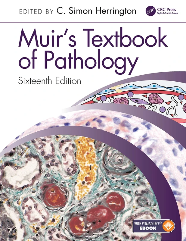 Muir's Textbook of Pathology: Sixteenth Edition International Student Edition